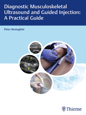 cover image of Diagnostic Musculoskeletal Ultrasound and Guided Injection